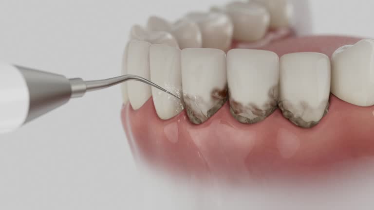 Trusted Tooth Extraction service in Monroe, LA - Dentist Open Now
